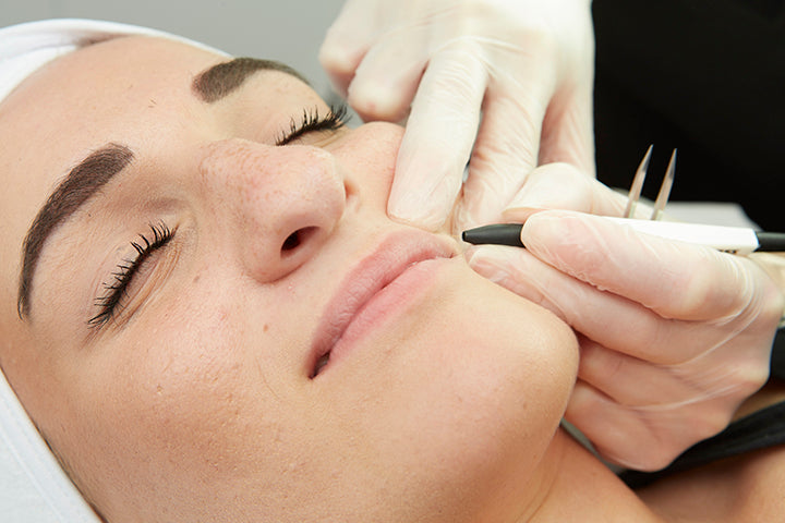 All You Need To Know About Electrolysis Hair Removal Treatment